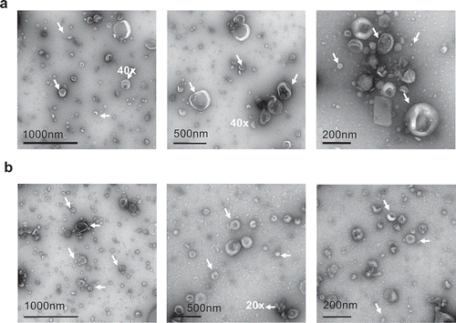 Figure 2. Electron microscopy images of SF-EV (a) non-labelled and (b) bio-maleimide-labelled pooled SF-EVs (n = 11) were analysed by transmission electron microscopy. SF-EVs between 20 and 300 nm in size were detected and protein aggregates were not found. Arrows mark SF-EVs detected in the samples.