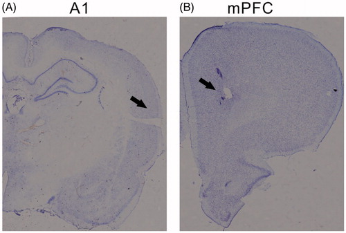 Figure 1. Reconstruction of the recorded locations on coronal brain sections. Three representative sections from the A1 and mPFC are at 4 mm posterior and 3.5 mm anterior to the bregma, respectively.