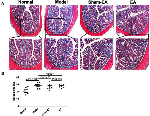 Figure 4 Expressions of collagen fibers in the distal colon in different groups. (A) Masson’s trichrome staining of the distal colon in each group. The collagen fiber was showed in blue, while the myofiber was shown in red (10×). (B) Quantitative expressions of collagen fibers in different groups of rats. *P<0.05.