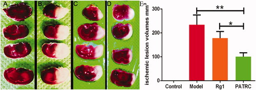 Figure 5. TTC staining of brain tissues. Brains tissues were cut into 2 mm thick slides then immersed in 1% TTC at 37 °C for 30 min. The pale regions were infarction tissues and the red regions were normal tissues. (A) Control group, normal rats treated with PBS; (B) model group, cerebral infarction model group treated with PBS; (C) Rg1 group, cerebral infarction model group treated with Rg1 (50 μmol/kg); (D) PATRC group, cerebral infarction model group treated with PATRC (containing 50 μmol/kg Rg1); E. Cerebral infarction volume of different groups.*p < .05,**p < .01.