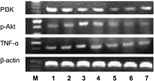 Figure 8.  Detection of TNF-α mRNA, PI3K mRNA, p-Akt mRNA and β-actin expression in CIA rats’ synovium. M: Marker, Lane 1: AR-6 high dose group, Lane 2: AR-6 middle dose group, Lane 3: AR-6 low dose group, Lane 4: model group, Lane 5: control group, Lane 6: MTX group, Lane 7: TGP group.