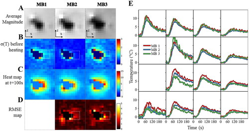 Figure 5. Influence of multiband acceleration factor. Experimental data obtained on a moving agar gel phantom using three different MR acquisitions with an MB factor of 1, 2, 3 respectively. (A). Average registered magnitude image close to the electrode (B), temporal standard deviation temperature maps (or temperature uncertainty) before heating (C) temperature maps during heating (D), RMSE maps over 60 consecutive temperature images acquired during RF delivery. Results for each acquisition are plotted: 1 (left), 2 (middle) and 3 (right). (E) Temperature evolution in a 4 × 4 kernel (see dashed square line) of voxels located close to the electrode with a multiband acceleration of 1 (in red), 2 (in blue) and 3 (in green). The slice number is 8.