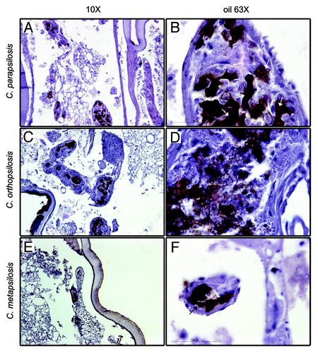 Figure 4. Histopathology of G. mellonella infection infected with 2 × 106 yeasts/larva of C. parapsilosis (A and B), C. orthopsilosis (C and D), and C. metapsilosis (E and F) at day 3 post infection. Panels show images taken with low magnification (A, C, and E) and high magnification (B, D, and F).