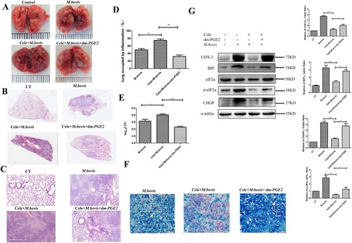 Figure 4. The deficiency of COX-2 promoted M. bovis infection by inhibiting ER stress and apoptosis. (A) The representative images of the lungs showed the gross pathological changes in a different group of mice (n = 6/group). (B) The representative images of the left lung lobe showed histopathological changes in a different group of mice (n = 6). (C) Higher magnification of H&E staining sections of the lungs and spleen showed M. bovis-induced lesions. Scale bar: 20 μm. (D) The percentage of the lung’s area occupied by inflammatory lesions was quantified by Image J software. (E) The total number of M. bovis bacilli in the lung tissues of infected mice as determined using the CFU assay. (F) Ziehl–Neelsen staining results showing the number of M. bovis in the lungs of mice with gut dysbacteriosis. (G) Western blot detection and the relative lung ratio of COX-2, BIP, p-eIF2α, and CHOP in the lungs of M. bovis-infected mice, Cele+ M. bovis mice and Cele+ M. bovis + dm-PGE2. α-tublin and eIF2α expression served as a lung control and was used for normalization (n = 3/group). Data are shown as mean ± SD, ***P < 0.001, **P < 0.01. *P < 0.05.