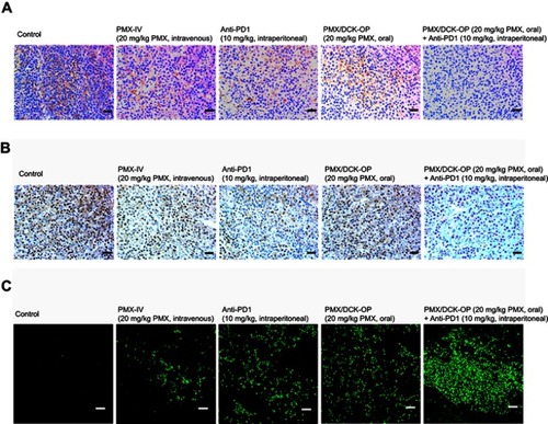 Figure 6 Representative cross-sectional images of isolated tumor tissues stained with (A) anti-CD31 antibody for microvessels (brown), (B) proliferating cell nuclear antigen (PCNA) for proliferating cells (brown), and (C) fluorescent terminal deoxynucleotidyl transferase-mediated dUPT nick end labeling (TUNEL) for apoptosis (green fluorescence) in the tumor tissues taken 14 days after treatment with various modes.Notes: The treatment modes were biweekly intravenous administration of 20 mg/kg PMX (PMX-IV), intraperitoneal administration of 10 mg/kg anti-PD1 (Anti-PD1) once every 3 days, once-daily oral administration of PMX/DCK-OP as 20 mg/kg of PMX (PMX/DCK-OP), and combined once-daily oral administration of PMX/DCK-OP as 20 mg/kg of PMX with once every 3 days intraperitoneal administration of 10 mg/kg anti-PD1 (PMX/DCK-OP + Anti-PD1). Scale bars represent 50 μm for anti-CD31 antibody and PCNA staining, and 20 μm for TUNEL staining, respectively.Abbreviations: PMX, pemetrexed; DCK, Nα-deoxycholyl-L-lysyl-methylester; PMX/DCK, ion-pairing complex between PMX and DCK; PMX/DCK-OP, oral powder formulation of PMX/DCK.