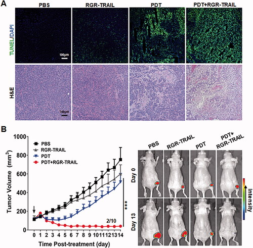 Figure 6. Combination therapy of RGR-TRAIL and EGFR-targeted PDT in mice bearing HT29 tumor xenografts. (A) Apoptosis induction and tissue damage mediated by monotherapy or combination therapy of RGR-TRAIL (5 mg/kg) and Ze-IR700-mediated PDT (1 mg/kg Ze-IR700, 60 J/cm2). After treatment overnight, apoptotic cells in tumor tissues were indicated by TUNEL, and tissue damage was visualized by H&E staining. (B) Tumor growth suppression mediated by monotherapy or combination therapy of RGR-TRAIL and Ze-IR700-mediated PDT. After treatment, the volume of HT29 tumor xenografts in mice (N ≥ 6) was measured daily. (C) Optical imaging of HT29 tumor xenografts treated with monotherapy or combination therapy of RGR-TRAIL and Ze-IR700-mediated PDT. For optical imaging, RFP-transgenic HT29 cells were subcutaneously injected into mice. After treatment, the mice were scanned daily.