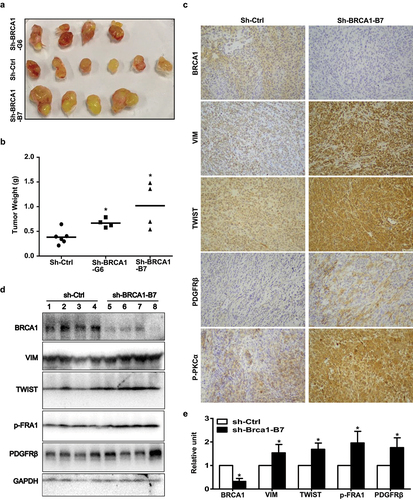 Figure 5. Knockdown of BRCA1 in human thyroid cancer cells promotes EMT and tumorigenesis. (a, b) B-CPAP-sh-Ctrl and B-CPAP-sh-BRCA1-G6 cells were inoculated into the left and right back of four NSG mice, respectively, in a pairwise manner. Similarly, B-CPAP-sh-Ctrl and B-CPAP-sh-BRCA1-B7 cells were inoculated into the left and right back of two NCG mice, respectively, in a pairwise manner. In addition, the same number of B-CPAP-sh-BRCA1-B7 cells were inoculated into the left back of two individual mice. Gross appearance (a) and weight (b) of the tumors formed 5 weeks later were analyzed. Data in (b) represent the mean ± SD of four tumors in each sh-BRCA1 group and six tumors in sh-Ctrl group. * p < 0.05 between the sh-Ctrl group and sh-BRCA1-G6 group, or between the sh-Ctrl group and sh-BRCA1-B7 group. (c, d) Representative tumors derived from sh-Ctrl and sh-BRCA1-B7 cell transplants were analyzed by IHC (c) and Western blot (d). (e) The protein levels of each lane in (d) were quantified by Image-Pro Plus 6.0 and normalized by that of GAPDH (right). Results represent the mean ± SD of four tumors per group.