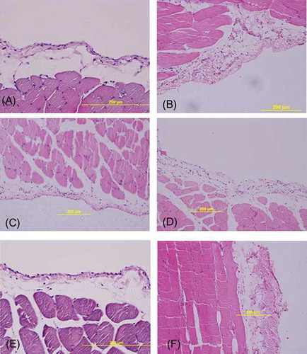 Figure 3.  H&E staining of representative samples of peritoneal tissues. (A) Control rat peritoneum. (B) In PD group, there was thickening of the submesothelial area with cell infiltration and neoangiogenesis. (C) In the MSC-2 group, there was similar submesothelial thickness compared to C group, and cellularity was increased. (D) In the P-2 group, submesothelial thickness increased with cellularity. (E) In the MSC-3 group, morphological changes did not significantly differ in C group. (F) In the P-3 group, marked peritoneal fibrosis with neovascularization was seen. Scale bars, 200 μm.