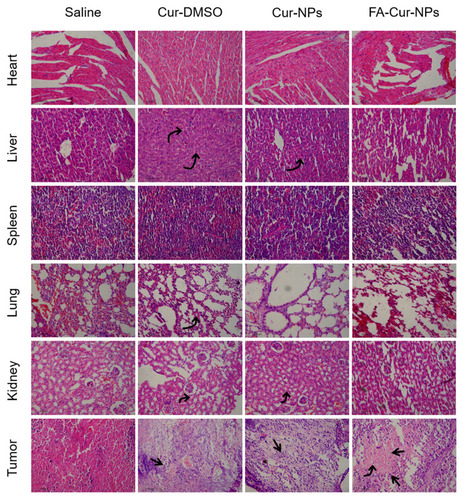 Figure 6 H&E-stained sections of organs resected from mice sacrificed 30 days after treatment. Straight arrows indicate tissue necrosis, and curved arrows indicate lymphoid infiltration.