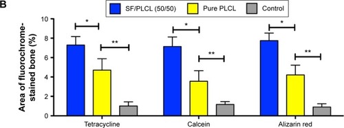 Figure 6 Fluorochrome labeling analysis of new bone formation and mineralization.Notes: (A) Row 1 (yellow) shows tetracycline labeling at week 2; row 2 (green) shows calcein at week 4; row 3 (red) shows alizarin red at week 6; row 4 shows merged images of the three fluorochromes for the same group; and row 5 shows merged images of the three fluorochromes with the plain image for each group. (B) The percentages of each fluorochrome area for the different groups showed significant differences among the SF/PLCL (50/50), pure PLCL, and control groups. *P<0.05, **P<0.01. Abbreviations: PLCL, poly(lactide-co-ε-caprolactone); SF, silk fibroin.