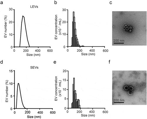 Figure 1. Characterization of LEVs and SEVs from D. Morbifera.