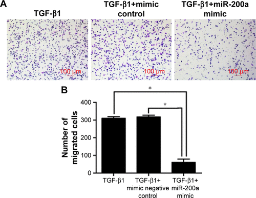 Figure S2 Transfection of miR-200a mimic inhibits the mobility of TGF-β-treated PC9 cells.