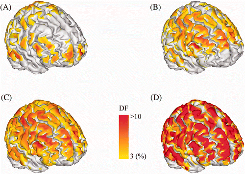 Figure 4. Localization accuracy of four cases mapped on the cortical surface: (A) EEG method; (B) MEG method; (C) conventional integration method and (D) proposed integration method. The colour code indicates the DF value assigned at the centre of each reference source patch. The colour map of the DF value was thresholded at 3%.