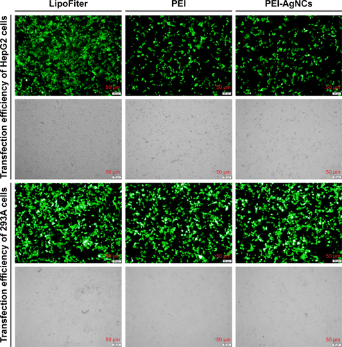 Figure S4 Fluorescence microscopic images of EGFP-C1 gene expression in different cells. Fluorescence microscopic images of HepG2 and 293A cells using different transfection carriers are shown. Gray images were taken under a bright-field. Scale bar, 50 µm.Abbreviation: PEI-AgNCs, polyethyleneimine-capped silver nanoclusters.