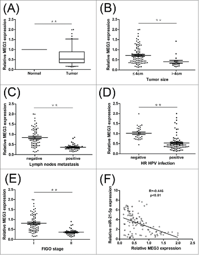 Figure 1. Relative MEG3 expression in cervical cancer tissues and its clinical significance. (A) Relative expression of MEG3 in cervical cancer tissues (n = 108) compared with adjacent normal tissues (n = 108). (B, C, D and E) MEG3 expression was significantly lower in patients with larger tumor size, lymph nodes metastasis, HR HPV positive and advanced FIGO stage. (F) Pearson's correlation coefficient analysis showed that miR-21-5p expression was negatively correlated with MEG3 in cervical cancer tissues. **P < 0.01.