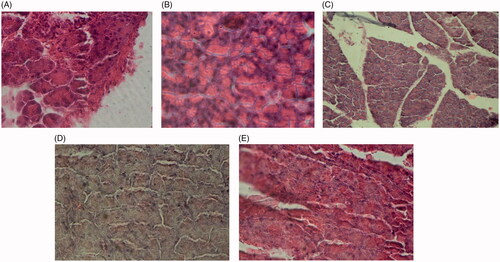 Image 3. Pancreas tissue sections of control rats (A), diabetic rats (B), diabetic rats treated with 75 mg/kg of S. bachtiarica extract (C), diabetic rats treated with 150 mg/kg of S. bachtiarica extract (D) and diabetic rats treated with 250 mg/kg of S. bachtiarica extract (E); haematoxylin-eosin staining; magnification x40.