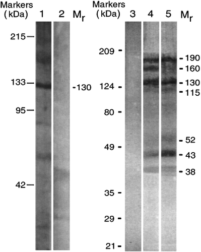 Figure 3.  Profiles of PV IgGs absorbed by recombinant Dsg 1 and Dsg 3 baculoproteins in the Western blots of keratinocyte proteins resolved by 7.5% SDS-PAGE. Lane 1, reaction of PV IgG purified on the rDsg3-His construct with human keratinocytes. Lane 2, no primary antibody control for lane 1. Lane 3, no primary antibody control for lanes 4 and 5. Lane 4, reaction of PV IgG purified on the rDsg1-Ig-His construct with Dsg3null keratinocytes. Lane 5, reaction of PV IgG purified on the rDsg3-Ig-His construct with Dsg3null keratinocytes. The positions of relative molecular mass (Mr) markers run in parallel lanes of each blot are shown to the left of the respective blot. The apparent relative Mr of keratinocyte protein bands visualized due to PV antibody binding is shown to the right of lanes 2 and 5 in the columns designated Mr. Modified from Ref. Citation[18].