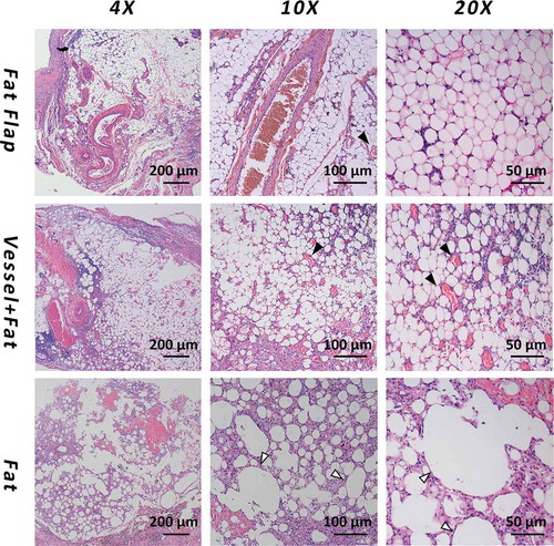 Figure 3. The H&E staining of adipose tissue in each group at week 6. The first line: adipocytes were homogenous, distributed around the axial blood vessels with a small number of inflammatory cells infiltrating. The second line: Most of the adipocytes showed normal morphology. A large amount of blood vessels within the generated stromal matrix could be observed with erythrocytes passing through showing a sign of functional blood vessels. The third line: The majority of tissue in group C was necrotic adipose tissue and it was wrapped in a thick capsule. Vessels were marked as black arrow and the necrotic droplet was marked as the white arrow