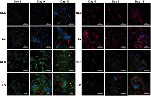 Figure 5. The expression of osteocalcin and vWF in BMSCs was detected by confocal microscope (200×; the scale bar represents 100 µm). The arrows in LC (day 13), LO (day 9 and day 13 left), NLD (day 13) and LD (day 9 and day 13) groupsin LC (day 13), LO (day 9 and day 13 left), NLD (day 13) and LD (day 9 and day 13) groups indicate cell accumulation. The arrows in NLO (day 13) and LO (day 13 right) groupsin NLO (day 13) and LO (day 13 right) groups indicate “lamellar-like” arrangement of cells, suggesting BMSCs differentiated into osteoblasts. The rings in LV (day 13) and LD (day 13) groupsin LV (day 13) and LD (day 13) groups in LV (day 13) and LD (day 13) groupsin LV (day 13) and LD (day 13) groups indicate “ring-like” structures, suggesting BMSCs differentiated into endothelial cells.