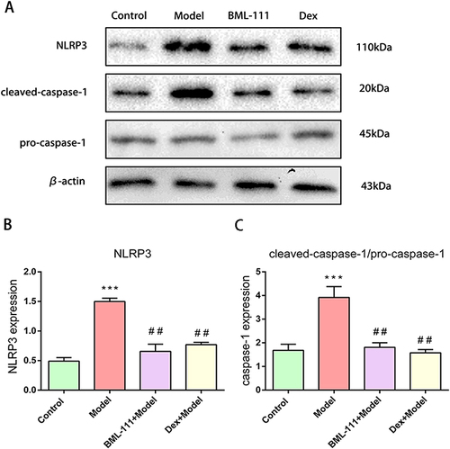 Figure 3 BML-111 inhibited CSE-induced NLRP3 inflammasome activation. (A) The protein expression levels of NLRP3, pro-caspase-1, and cleaved-caspase-1, observed using Western blot assay. (B and C) Semi-quantitative analysis of NLRP3 and cleaved-caspase-1/pro-caspase-1 ratio. The values shown are the mean±SD. (n=3/***p<0.01 vs Control group; ##p<0.01 vs model group).