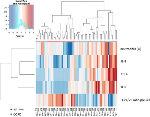 Figure 1 Hierarchical clustering heatmap of asthma and COPD patients based on clinical, sputum cytokine and cellular features. The rows and columns are ordered based on the results of hierarchical clustering with dendrograms for the patients shown on the horizontal axis and clinical and laboratory data shown on the vertical axis. The colour scale codes normalized value of a variable with red corresponding to the highest value.
