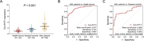 Figure 1. Circ-PVT1 expression in AML patients, disease controls and health donors. Comparation of circ-PVT1 among health donors, disease controls and AML patients (A). The value of circ-PVT1 in distinguishing AML patients from health donors (B). The value of circ-PVT1 in distinguishing AML patients from disease controls (C). PVT1, plasmacytoma variant translocation 1; AML, acute myeloid leukemia.