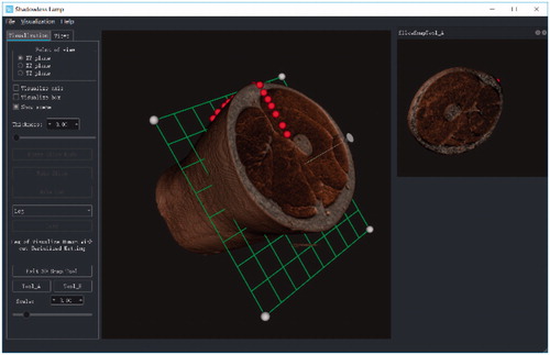 Figure 11. Preliminary system interface of a computer-assist virtual surgery system.