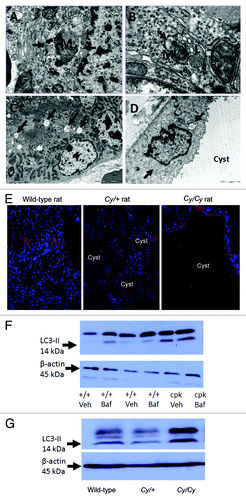 Figure 4. Autophagy in PKD. Autophagosomes (arrows) are demonstrated in kidneys of +/+ rats (A), Cy/+ rats (B), +/+ mice (C) and in the tubular cells lining the cysts in cpk mice (D). Lysosomes (L) fusing to autophagosomes are shown in (B). Mitochondria (M) within a autophagosome (mitophagy) is shown in (A and B). Reproduced from Belibi et al.,Citation158 with permission from the American Physiological Society. Magnification is X20000 in (A), X40000 in (B), X6000 in (C) and X12000 in (D). (E) To demonstrate that LC3 is present in the cells lining the cysts, IF was performed. There is LC3 stainingCitation187 in cells lining the cysts in Cy/+ and Cy/Cy rats. Nuclei are represented by blue (DAPI) staining. LC3 staining is cytosolic. Reproduced from Belibi et al.,Citation158 with permission from the American Physiological Society. (F) The intensity of the LC3-II bands was increased in cpk mice compared with wild type (+/+) mice. In +/+ mice treated with bafilomycin A1 (+/+ Baf), there was an increase in LC3-II. In cpk mice treated with bafilomycin A1 (cpk Baf), LC3-II was not increased. (G) LC3-II was increased in Cy/Cy rats compared with +/+ and Cy/+ rats. ACTB/β-actin used as a loading control was not different between the groups. Reproduced from Belibi et al.,Citation158 with permission from the American Physiological Society.