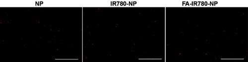 Figure 4 Fluorescence images of NP, IR780-NP, and FA-IR780-NP labeled with DiI. The scale bars are 5 μm.