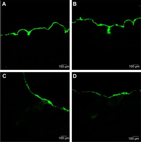 Figure 6 Laser scanning microscope images of the penetration of FITC-Fe3O4-SF nanoparticles.Notes: (A) Control; (B) stationary magnetic field; (C) alternating magnetic field; and (D) stationary/alternating magnetic fields.Abbreviations: FITC, fluorescein isothiocyanate; SF, silk fibroin.