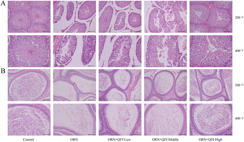 Figure 2. QJT alleviated the pathology of testis and epididymis in ORN-treated rats. Testis and epididymis tissues were assessed by H&E staining.