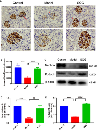 Figure 5 SQG ameliorates glomerular podocyte damage in NS rats, nephrin and podocin expression as examples. (A) Nephrin immunohistochemical staining images (scale bar: 50μm and 20μm). (B) Immunohistochemistry analysis of Nephrin. (C–E) Representative Western blot analysis of nephrin and podocin levels in kidney tissue. Data are presented as the mean ± s.d. ***p < 0.001, ****p < 0.0001, vs Control group. ##p < 0.01, ####p < 0.0001, vs Model group. n = 3 samples per group.