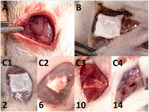 Figure 1. Surgical procedure and gross wound appearance. (A) A craniectomy was performed, and adequate hemostasis was attained. (B) Hybrid-structured nanofibrous membranes were placed onto the brain cortex. (C1-4) The number at the lower left corner of each image indicates the number of weeks after the implantation of the poly[(D,L)-lactide-co-glycolide] (PLGA) nanofibrous membrane. The scalp wound and brain tissue were quite clear, and no infection (exudate, pus, or granulation) was observed. The biodegradable PLGA nanofibrous membrane degraded with time, with only a small amount of the residual PLGA nanofibers (indicated by the black arrow) by the end of the study (week 14).