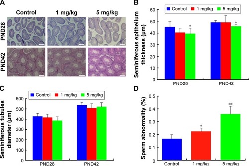 Figure 9 Structural alteration of seminiferous tubules and abnormal sperm morphologies of mice injected with ZnO NPs.Notes: (A) Representative histological sections of control and treated testes. Scale bars =100 μm. (B) Measures of the seminiferous epithelium thickness of testicular tubules of control and treated mice. (C) Measures of the diameter of the seminiferous tubules of control and treated mice. (D) Percentage of abnormal sperm morphologies (double head, small head, unshaped head, double tail) in control and treated mice. The results are expressed as the mean ± standard deviation of three separate experiments, in triplicate. *P<0.05, **P<0.01.Abbreviations: NPs, nanoparticles; PND, postnatal day.