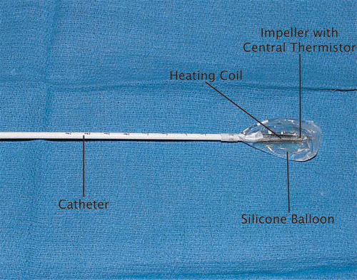 Figure 4. Balloon-catheter with heating coil at its center.