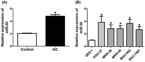 Fig. 1. Expression of miR-30 in GC tissues and cell lines.