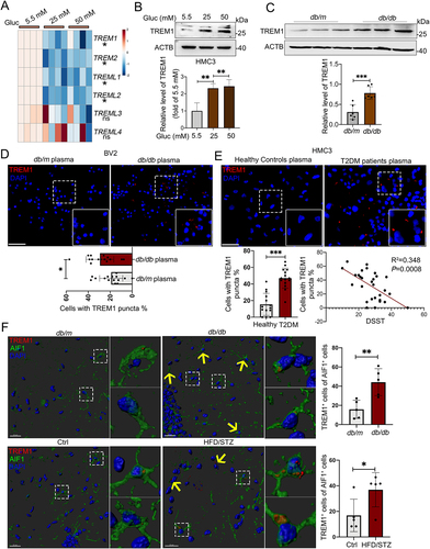 Figure 4. Increased protein level of TREM1 in hyperglycemic plasma or HG-cultured microglia and in the hippocampal microglia of db/db mice. (A) the mRNA expression levels of TREM and TREML receptors were analyzed by RT-Qpcr and TREM1 protein expressions was detected via western blotting (B). ACTB was used as control. (C) Western blotting analysis of TREM1 protein expressions and (D) confocal images of TREM1 in BV2 cells treated with plasma of db/db mice. Scale bar: 50 μm. (E) Confocal images of TREM1 in HMC3 cells treated with T2DM patients plasma. The number of TREM1+ cells were quantified. Scale bar: 50 μm. (F) Representative Imaris 3D reconstructions of TREM1-positive expression in IBA+ microglia of the hippocampi of db/db and HFD/STZ mice. TREM1-positive cells were quantified. Scale bar: 50 μm. *P < 0.05, ** P < 0.01, *** P < 0.001.
