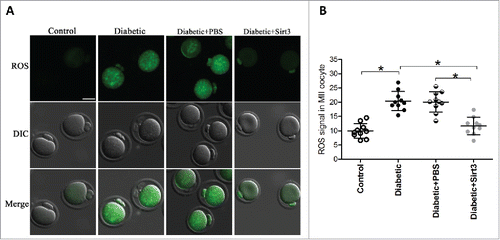 Figure 3. Sirt3 overexpression attenuates ROS production in oocyte. Exogenous Myc-Sirt3 mRNA or PBS was microinjected into fully-grown GV oocytes from diabetic mice, which were arrested at GV stage in M16 medium containing 2.5 μΜ milrinone for 20 hours to allow synthesis of new Myc-Sirt3 protein. Following in vitro-maturation, MII oocytes were stained by CM-H2DCFAD (green) to evaluate ROS levels. (A) Representative images of CM-H2DCFAD fluorescence in control, diabetic, diabetic+PBS and diabetic+Sirt3 oocytes. Scale bar: 25 μm. (B) Quantitative analysis of fluorescence intensity shown in B (n = 10 oocytes for each group). Data were expressed as mean ± SD from 3 independent experiments. *p < 0.05 vs control.