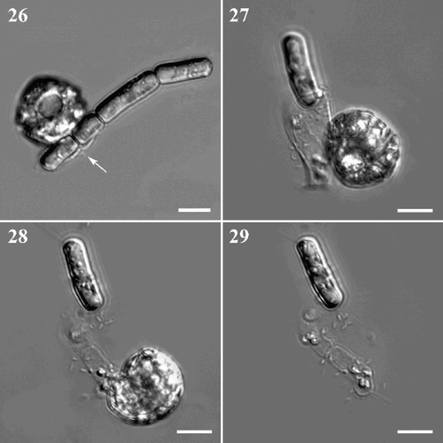 Figs. 26–29. Feeding behaviour of Protoperidinium vorax sp. nov. Fig. 26. P. vorax starts to surround a colony of Skeletonema pseudocostatum with the pallium (arrowed). Fig. 27. Final phase of the feeding process, the empty diatom is still surrounded by the pallium. Fig. 28. P. vorax retrieves the empty pallium (same cells as in Fig. 27). Fig. 29. Empty diatom frustules left behind after feeding is completed (same cells as in Figs 27 and 28). Scale bars: 10 µm.