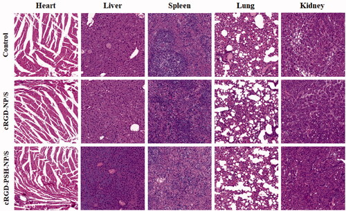 Figure 8. In vivo safety evaluation of the nanoparticles. Hematoxylin and eosin (H&E) staining images (40×) of tissue sections from mice after the continuous injection of normal saline, cRGD-NP/S and cRGD-PSH-NP/S for 21 days. Tissues were harvested from heart, liver, spleen, lung and kidney.