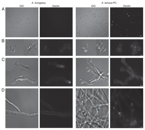 Figure 1 Differential dectin-1 binding on Aspergillus fumigatus and Aspergillus terreus phialidic conidia. Soluble dectin-1 binding A. fumigatus and A. terreus phialidic conidia at various stages of germination (A) dormant conidia (B) swollen condia (C) early germ tube formation and (D) late germination. Differential interference microscopy (DIC) and fluorescence images were captured by microscopy at 40x (A) and 100x (B–D), and are representative of 3 experiments. Scale bars denote 5 µm and 10 µm for 40x and 100x magnification, respectively.