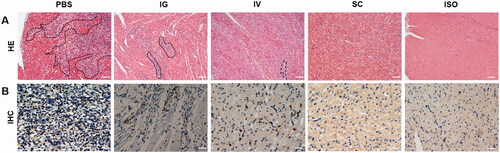 Figure 5. Histological and immunohistochemistry analysis of PLGA-FK506-NPs treatment via various administration on POD 7. (A) H&E staining of the tissue sections. Scale bar = 100 μm. (B) Immunohistochemistry staining with CD3+ T lymphocytes. Scale bar = 20 μm. Areas in black dotted lines indicate the areas of lymphocyte infiltration and myocyte damage.