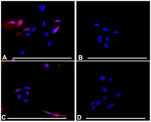 Figure 7 Selective uptake of A415-PCL by ATRA-treated SH-SY5Y cells, the selectivity being dependent on incubation time. (A) ATRA-treated SH-SY5Y cells incubated with A415-PCL for 20 minutes. (B) ATRA-treated SH-SY5Y cells incubated with Scr-A415-PCL for 20 minutes. (C) ATRA-treated SH-SY5Y cells incubated with A415-PCL for 4 hours. (D) ATRA-treated SH-SY5Y cells incubated with Scr-A415-PCL for 4 hours.Note: Bar corresponds to100 μm.Abbreviations: ATRA, all-trans-retinoic acid; PCL, peptide-conjugated liposomes.