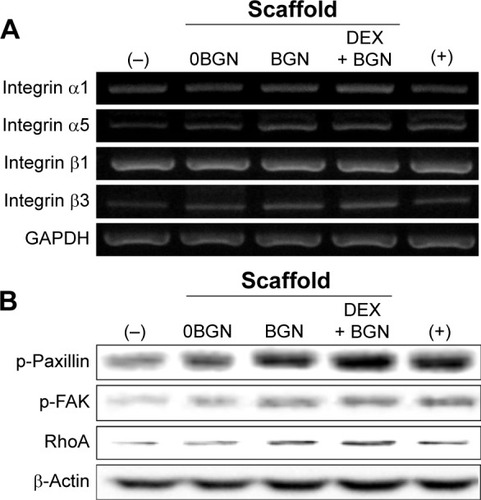 Figure 5 Integrin signaling pathway analyses.Notes: (A) mRNA expressions of integrin subsets (α1, α5, β1, and β3), by RT-PCR. GAPDH was used as the housekeeping gene. (B) Protein expressions of intracellular adhesive molecules (p-Paxillin, p-FAK, and RhoA), by Western blot. β-actin was used as the control.Abbreviations: RT-PCR, reverse transcription polymerase chain reaction; p-FAK, phospho-focal adhesion kinase; BGN, bioactive glass nanoparticle; DEX, dexamethasone; GAPDH, glyceraldehyde 3-phosphate dehydrogenase.