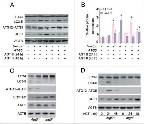 Figure 7. ATG5 inhibits AGT II-induced COL1 expression in vitro. (A) HK-2 cells were transfected with either pcDNA3.1-ATG5 or pcDNA3.1-HA vector before stimulation with 10−6 mol/L of AGT II for 24 or 48 h. Cell lysates were analyzed by immunoblotting with the indicated antibodies. (B) Densitometry of LC3-II and COL1 proteins in immunoblots. Data are means ± SEM (n = 3); *, P < 0.05 vs. negative and empty control; #, P < 0.05 vs. control and AGT II-treated cells for 24 h with or without ATG5 overexpression; §, P < 0.05 vs. control and AGT II-treated cells for 48 h without ATG5 overexpression. (C) Expression of LC3, ATG12–ATG5 conjugation, SQSTM1/p62, and LRP2/MEGALIN in primary TECs from Atg5+/+ and atg5−/− mice were assessed by Western blot analysis. (D) Primary TECs from Atg5+/+ and atg5−/− mice were stimulated with 10−6 mol/L of AGT II for 24 or 48 h. Cell lysates were probed with antibodies against the indicated proteins.