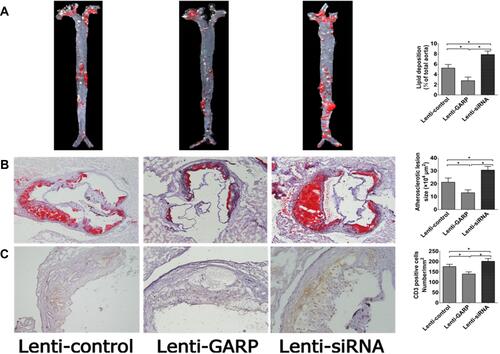 Figure 4 The overexpression of GARP inhibit development of atherosclerotic plaques in ApoE−/- mice. (A) Oil red staining and quantitative analysis of atherosclerotic lesion size in aortic sinus. (B) The area of atherosclerotic plaque in thoracic aortas in ApoE−/- mice. (C) CD3 staining and quantitative analysis of infiltration of T lymphocytes in atherosclerotic lesion of aortic sinus in ApoE−/- mice. The black bar represents 200μm. Horizontal bars represent means. *P <0.05.