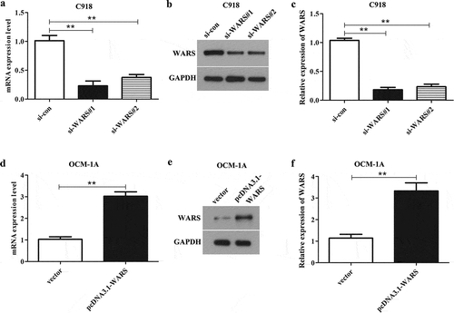 Figure 3. The efficiency of WARS knockdown/overexpression in UM cell lines C918 and OCM-1A. (a, b, and c) The expression of WARS was markedly decreased in C918 cells after transfected with si-WARS#1 and si-WARS#2 than that in si-con group. (**P < 0.01) (d, e, and f) The expression of WARS was markedly increased in OCM-1A cells after transfected with pcDNA3.1-WARS than that in the vector group. (**P < 0.01).