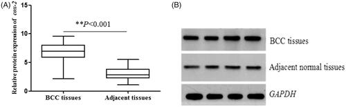 Figure 2. Cox-2 protein expression was detected by western blot analysis. The protein expression of cox-2 in BCC tissues were significantly higher than that in adjacent normal tissues (p < .001).