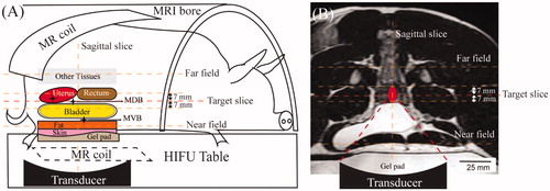 Figure 1. (A) Illustration of the experimental setup showing the animal’s position, MR thermometry slices, locations of MR coils, gel pad, and treatment organs. Stars indicate the three target areas: MVB (muscle adjacent to the ventral bladder wall), MDB (muscle adjacent to the dorsal bladder wall), and uterus. (B) Coronal slice of the MR images overlays with the schematic illustration of the beam path and the transducer in a HT session in the treatment of the uterus as an example.