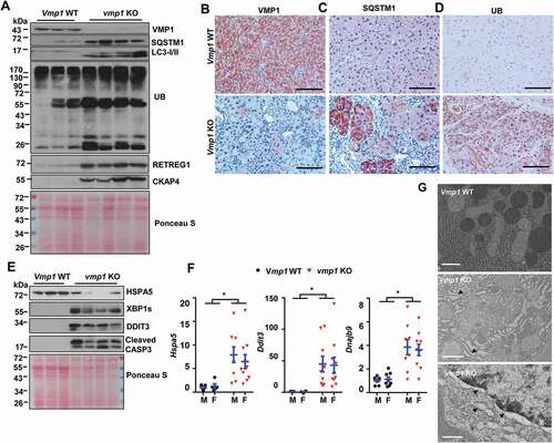 Figure 4. Loss of acinar cell VMP1 impairs autophagic degradation and induces ER stress. Immunoblotting analysis using total lysates from pancreatic tissues for autophagy markers (A). Representative images of IHC staining of (B) VMP1, (C) SQSTM1, and (D) ubiquitin (UB) from 2-months-old WT and vmp1 KO mouse pancreatic tissues. Bars: 100 µm. Immunoblotting analysis for ER stress (E) markers. (F) Pancreatic mRNA was extracted followed by qPCR analysis. Results were normalized to Rpl13a and expressed as fold change compared to Vmp1 WT group. M: male; F: female. Data shown are mean ± SE (n = 4–10). **p < 0,01; Student t-test analysis. (G) Representative EM images of pancreatic tissues from WT and Vmp1 KO mice are shown. Bars: 500 nm. Arrowheads: dilated ER.